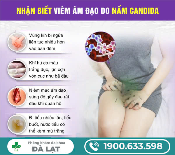 Hình ảnh minh họa